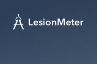 Lesionmeter - измерение площади язв